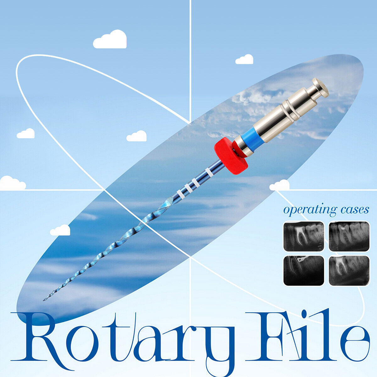 Dental Niti Files Endo V Blue Engine Use Root Canal Rotary Files 21mm /25mm