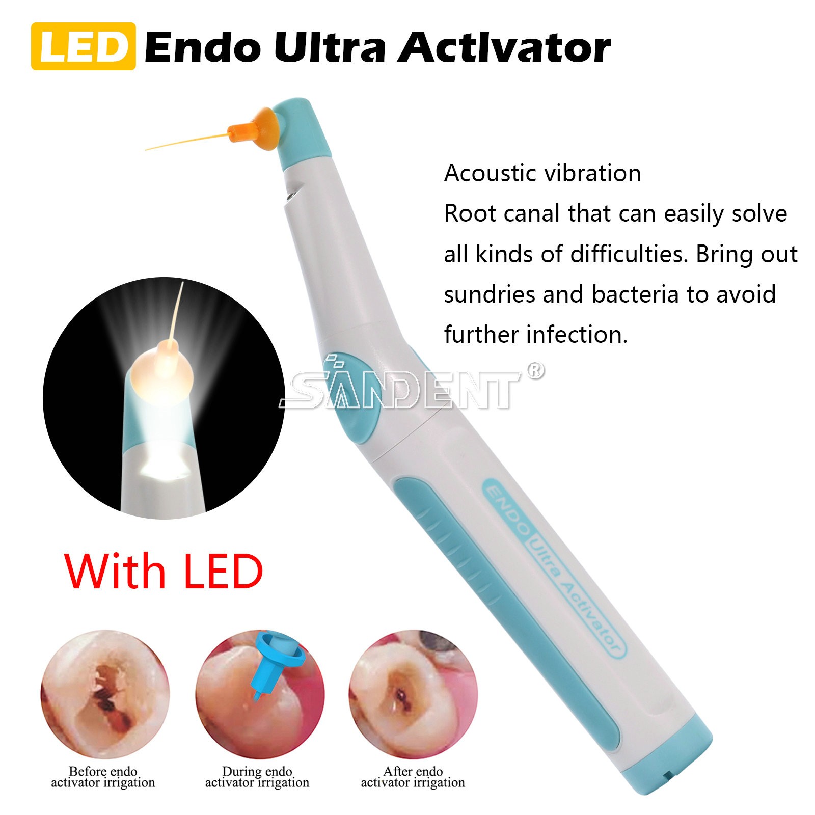 Dental Wireless Ultrasonic Activator Endo Ultra Activator with 150 Tips Blue US