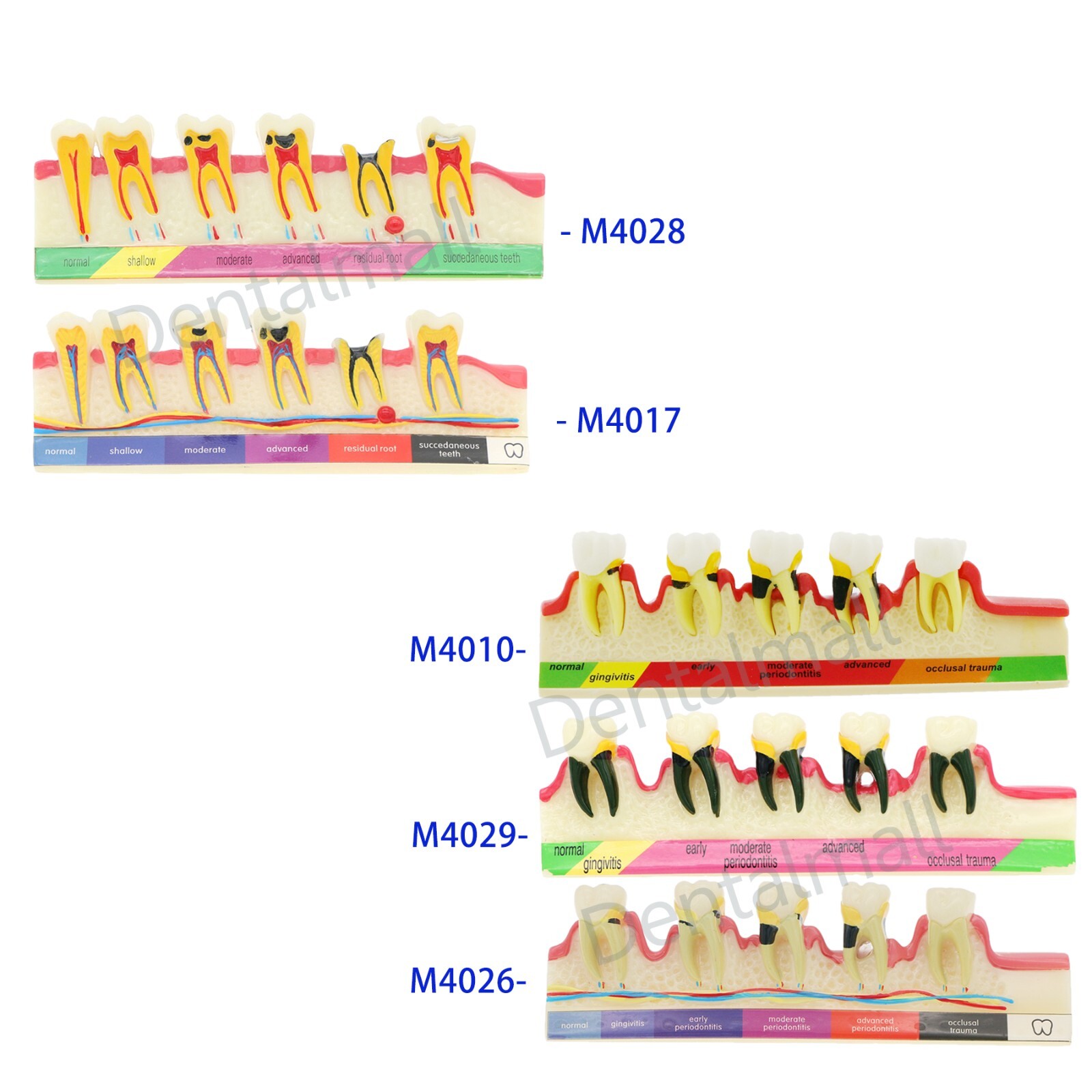 Dental Typodont Teeth Model Overdenture Implant Practice Endo Ortho Teachi Study