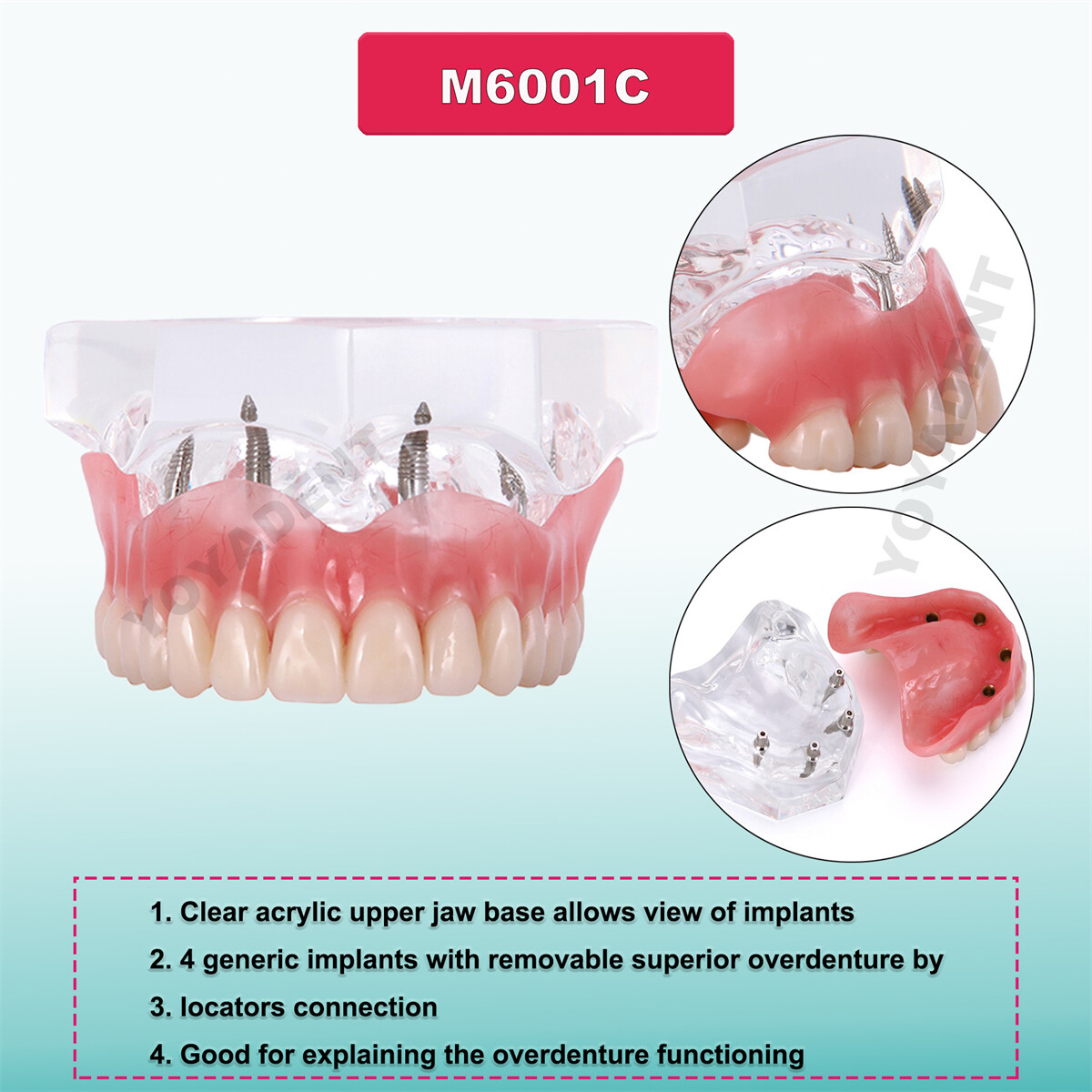 US Dental Teeth Model Implant Periodontal Disease Suture Drilling Training Demo